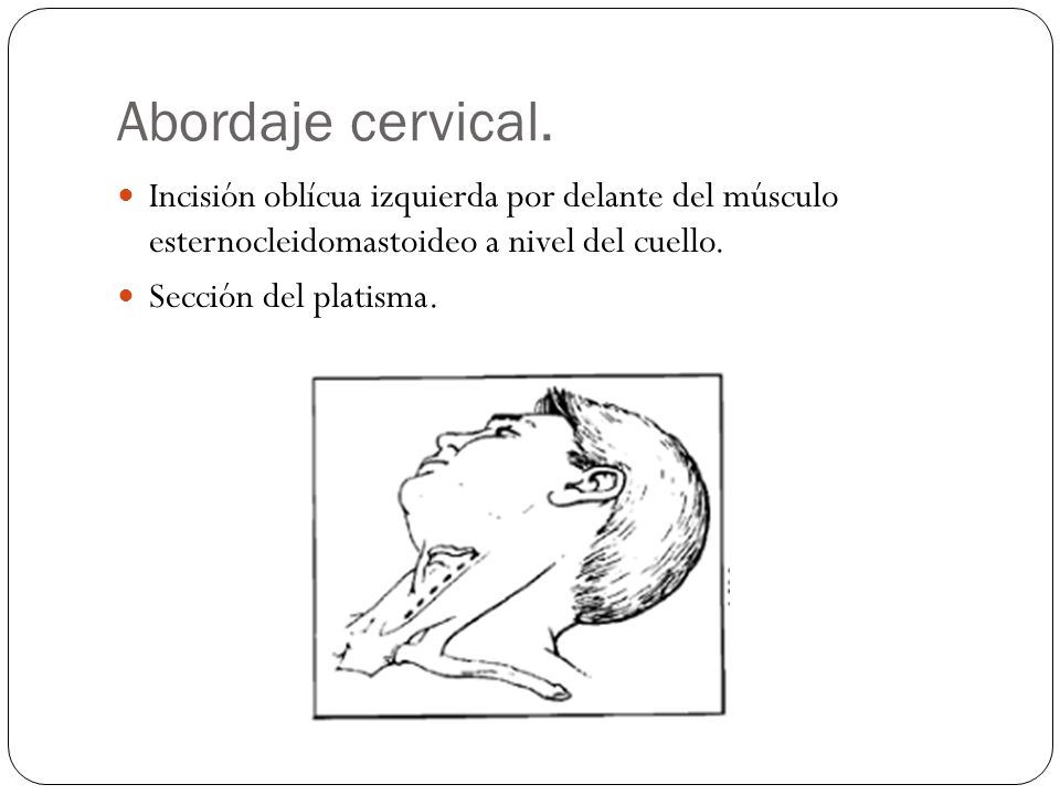 Sheynyy el departamento de la columna vertebral de la enfermedad los síntomas y el tratamiento